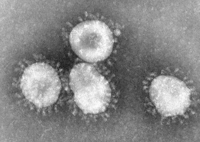 Fichier:Coronaviruses 004 lores.jpg
