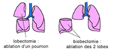 Fichier:Poumon.png