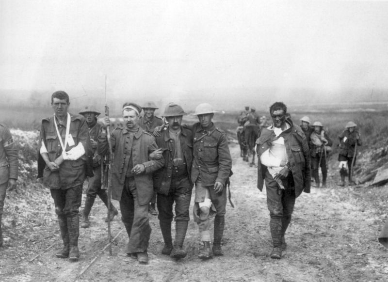 Datei:800px-British wounded Bernafay Wood 19 July 1916.jpg