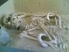 Skelett1.jpg