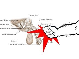 File:Anatomy of a cockpunch.jpg