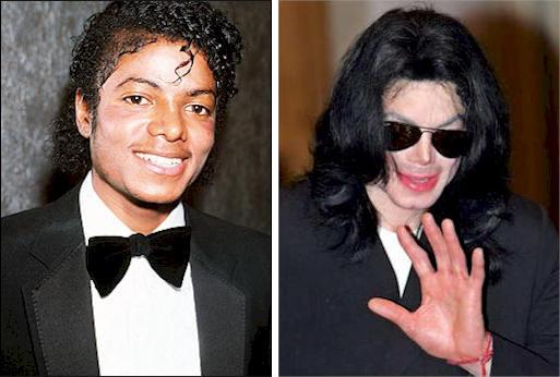 File:Michael-jackson-before-and-after.jpg