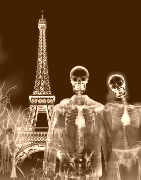 File:X-ray sepia.png