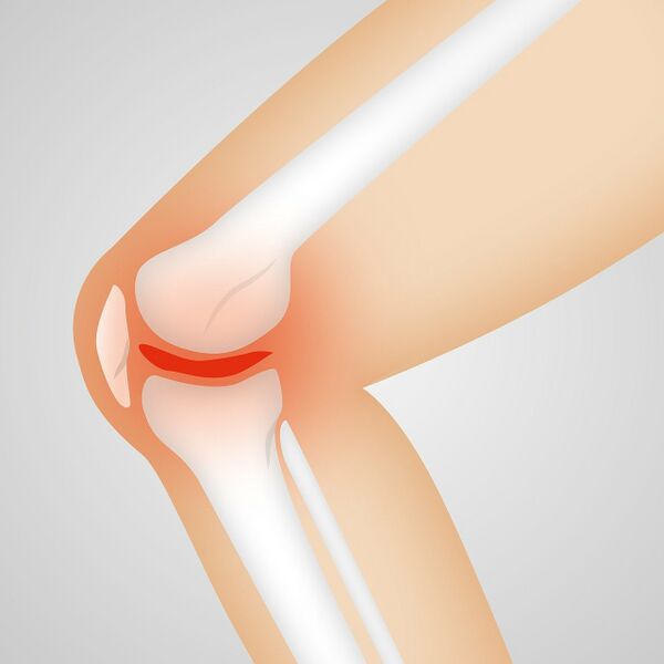File:Kneerizzity.jpg