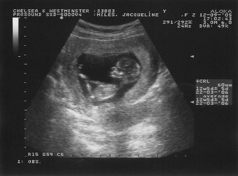 File:Baby1 12weeks.jpg