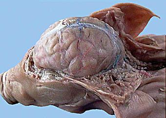 Fichier:Dissection cerveau.jpg