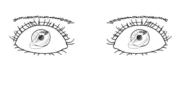 Fichier:Chauss-eye-norm.png
