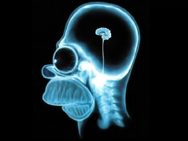 Fichier:Cerveau Homer.jpg