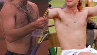 Fichier:Agassi-hair-loss.png