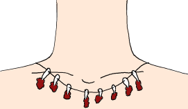 Fichier:Collier-meaty.png