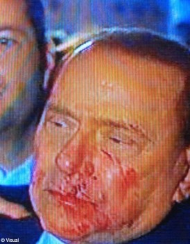 Fichier:Silvio-Berlusconi-en-sangde une.jpg