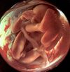 Foetuss.jpg