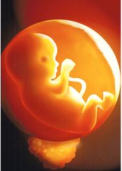 Foetus.jpg