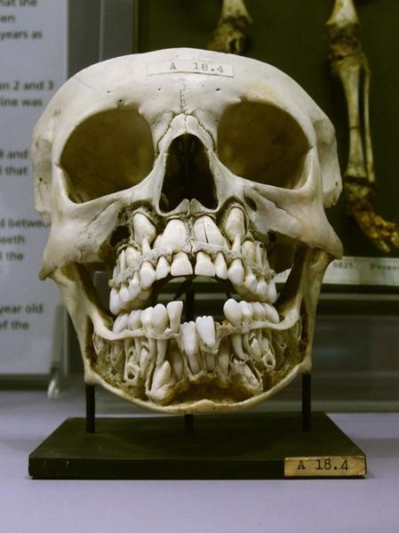 Fichier:Crâne de Jan Waringen le Brave.jpg