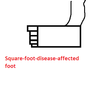 File:Foot^2.png