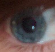 File:My eye.jpg