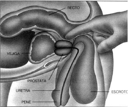 Archivo:Examen prostata.gif