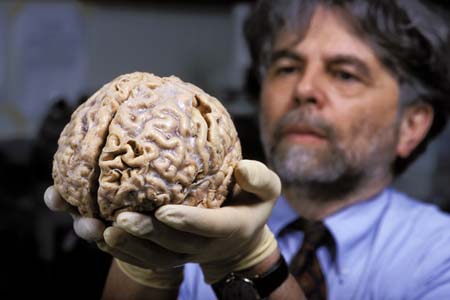 Archivo:Kalil Ron.Cerebro humano.jpg