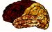 Cerebropodrido.jpg