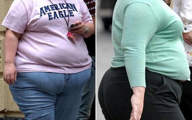 Soubor:Obese women.jpg