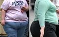 Obese women.jpg
