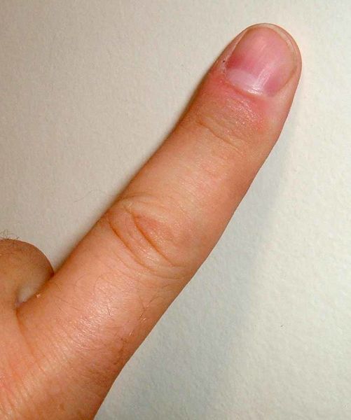 Soubor:Finger.agr.jpg