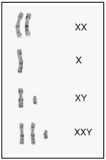 File:Chromosomes.jpg
