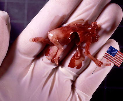 File:Patriotic Fetus.jpg