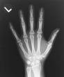 File:X-ray hand.jpg
