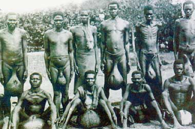 File:AfricabubaltribeHUGEesticles.jpg