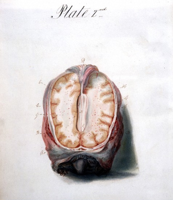 File:Illustration of Brain.png