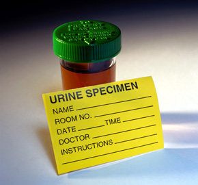 File:Urine sample pd.jpg