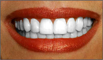 File:Richard hammond teeth.jpg