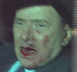 File:Berlusconi hit.jpg