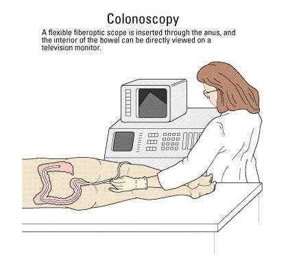 File:Colonoscopy.jpg