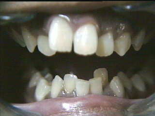 File:Unnews crooked teeth.jpg