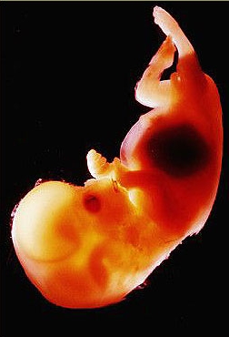 File:Fetus.jpg