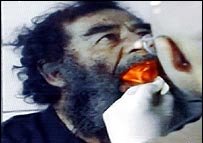 File:Saddam dental inspection.jpg