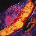 Tuberculosis Mycobacterium.jpg