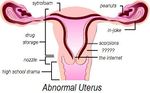 Abnormaluterus.jpg