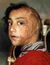 Burnt-child.jpg