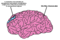 Brain.png