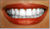 Richard hammond teeth.jpg
