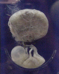 Fetus 3 months.jpg