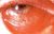 Boiled eye.jpg