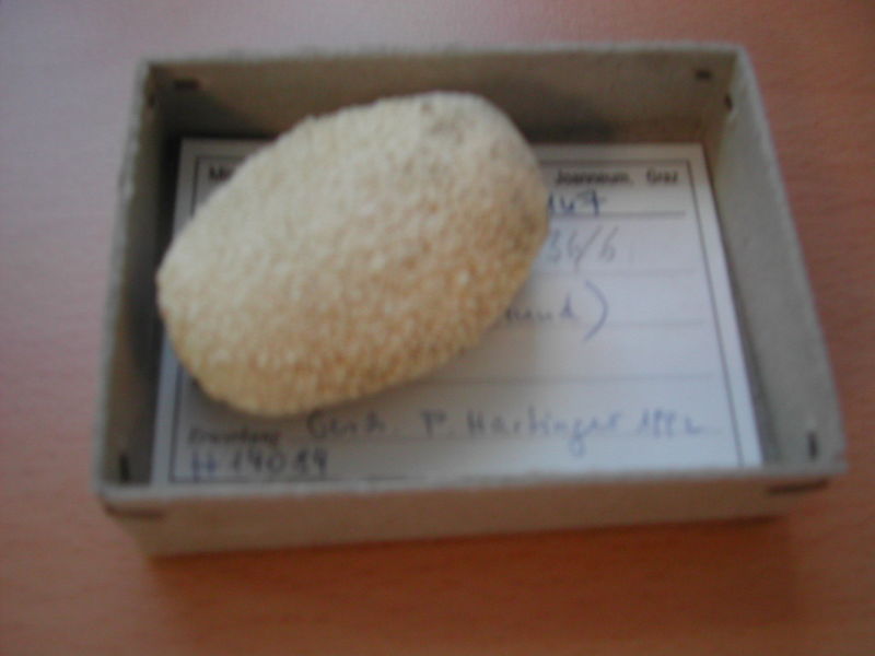 File:Kidney stone.jpg
