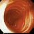 Small intestine.jpg