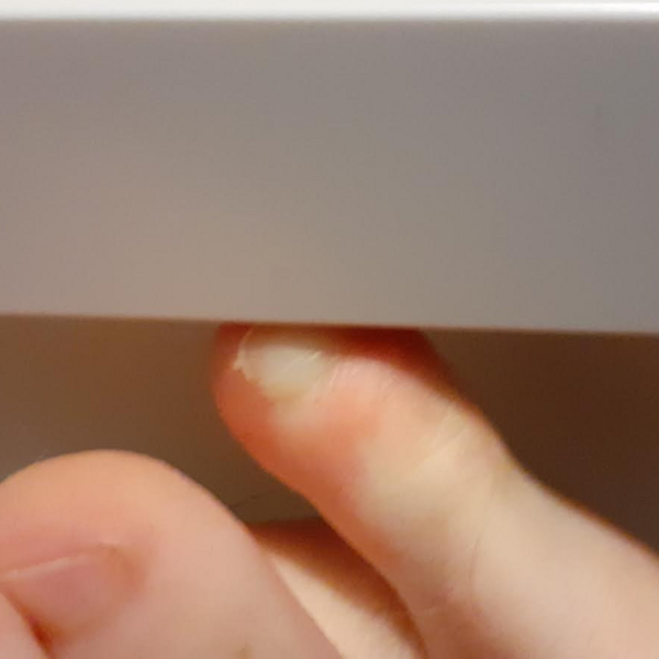 File:Stubbed toe.png