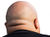 Neckfat.jpg