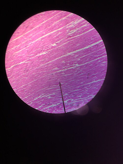 File:Smooth Muscle Tissue.jpg